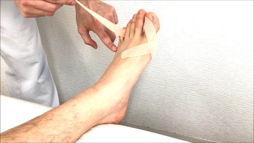 外反母趾のテーピング 横浜シード治療院の自宅で簡単に出来るテーピング講座 大倉山駅前 Yokohama Seed 横浜seedはり灸 マッサージ院 Seed Gym