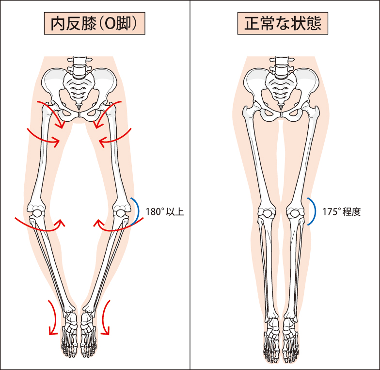 女性を悩ますｏ脚の正体 大倉山駅前 横浜seed整骨院