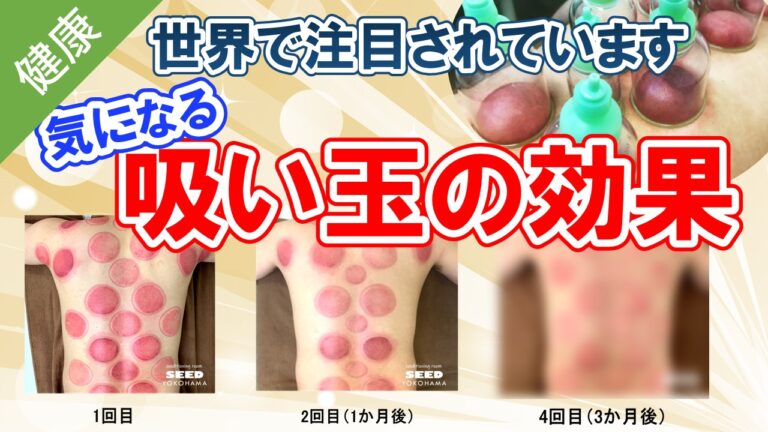 カッピングの料金はいくらくらいですか?