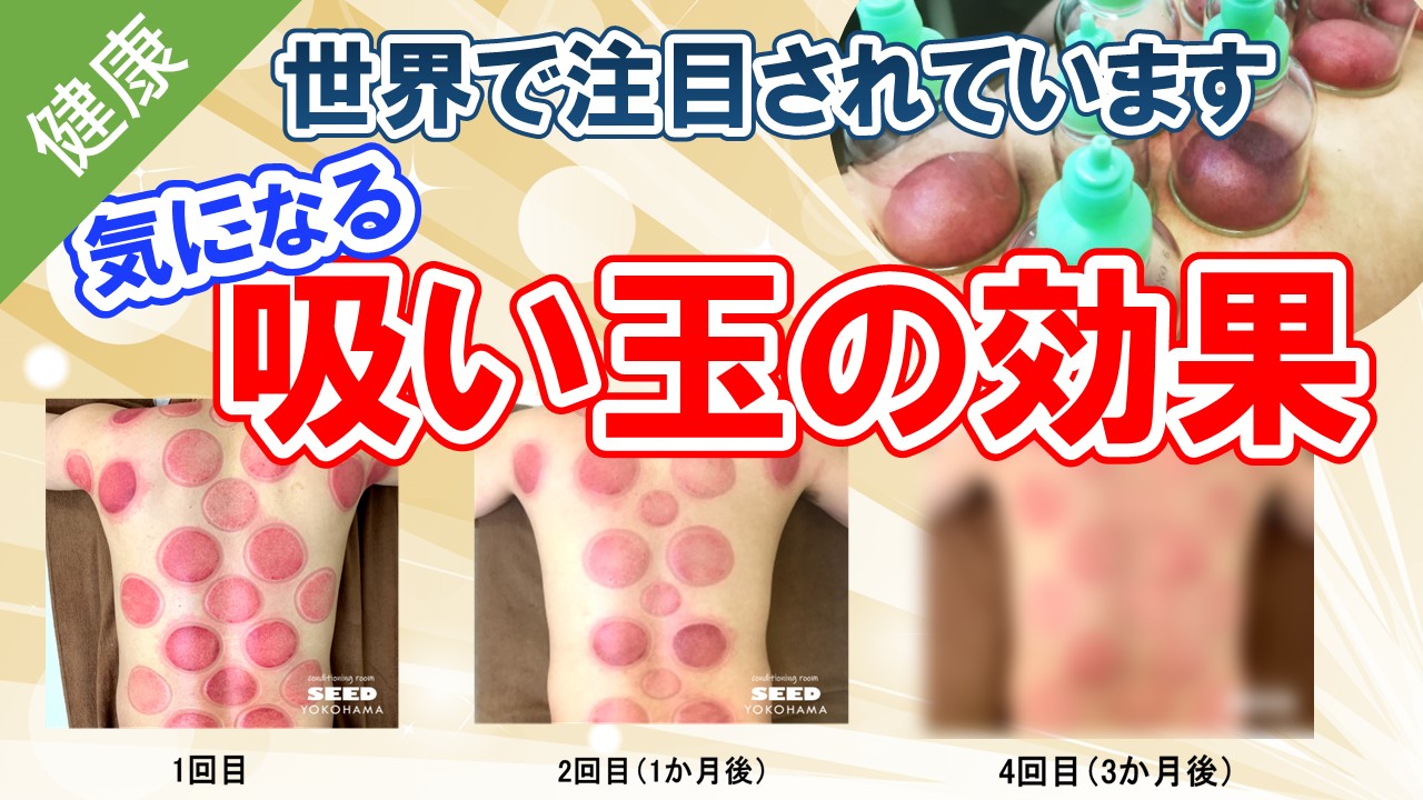 取り除く