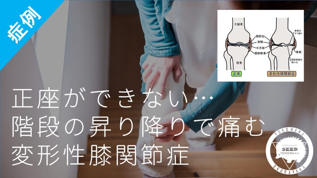 変形性膝関節症