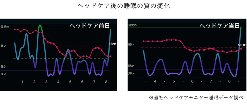 睡眠データ